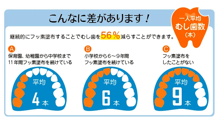 3か月おきの「フッ素&検診」でお子様の歯を守っていきましょう|小児治療