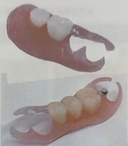 ノンクラスプ義歯①